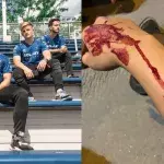 Kinstaar Fortnite agression